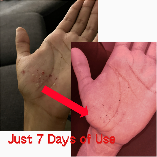 Glysolid Glycerin Cream